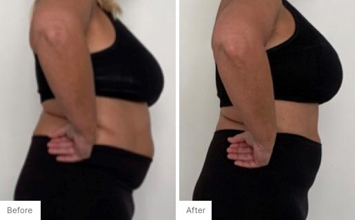 10 - Before and After Real Results image of a woman that has used the NeoraFit™ New Year Reset Program.